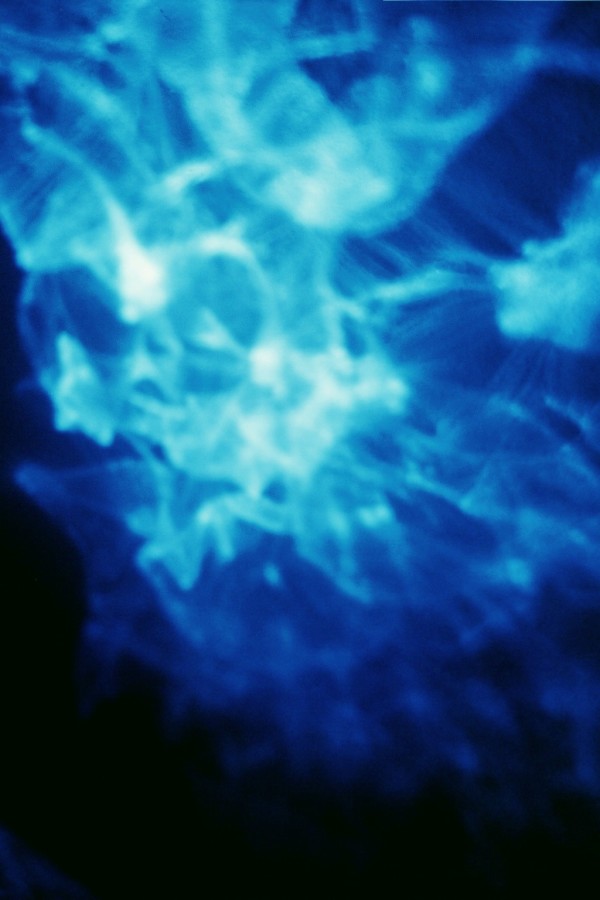 Blue Series 1 (Emergence), Image 20.