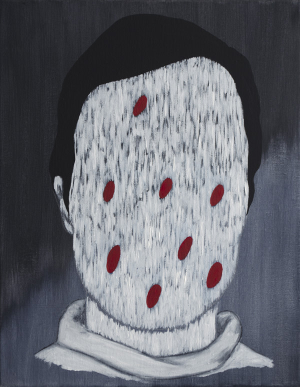 Mosquito Bites by Lee Clarke