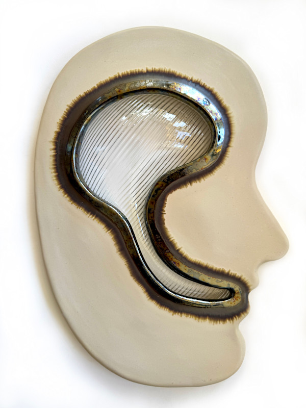 Anomic Aphasia by Kelly Witmer