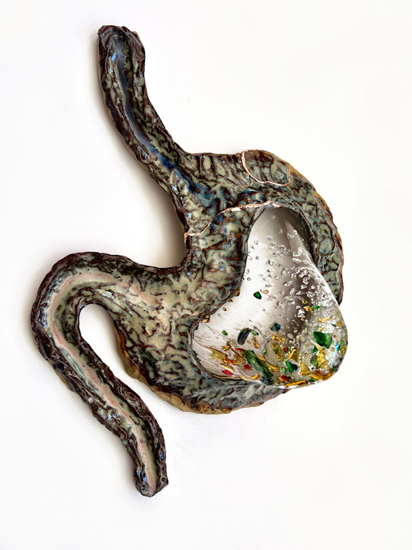Rollercoaster Stomach by Kelly Witmer, Image 1.