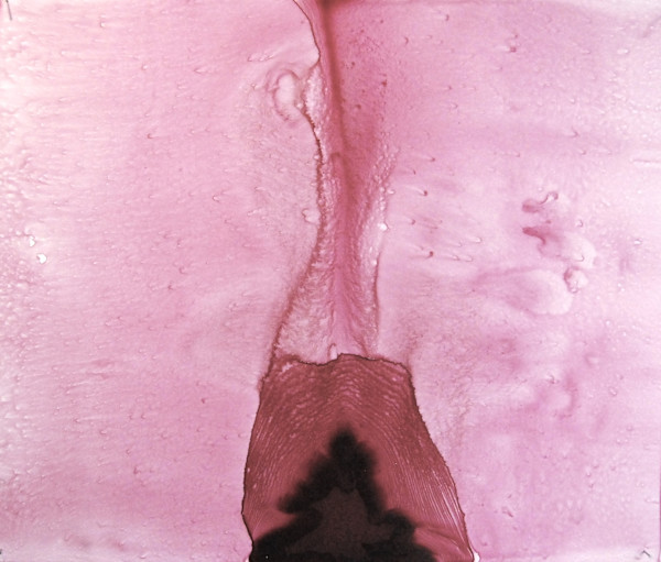 MEDULLA 3 by STEPHANIE HARGRAVE, Image 1.