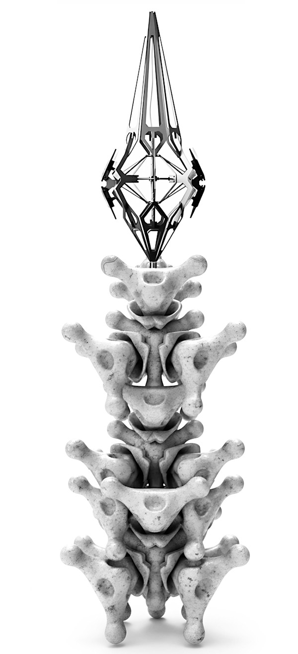 Meterial by Yucen Liu, Image 3.