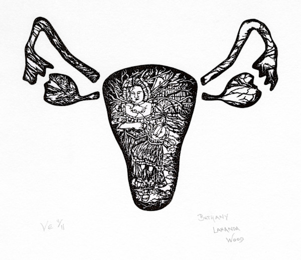 R-Hysterectomy: Impression VE 11/11 by Bethany Laranda Wood