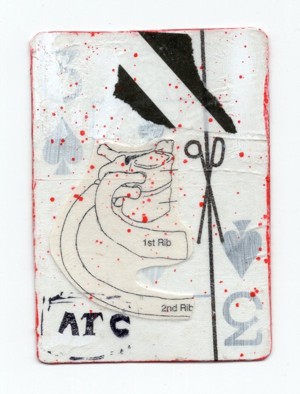 3 of Spades (Abortion Trading Cards) by Alexandra Jamieson