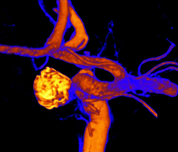 COILS #44 by Curtis Dickman