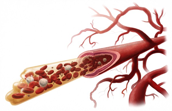 Inside a Blood Vessel by C. J. Ellison