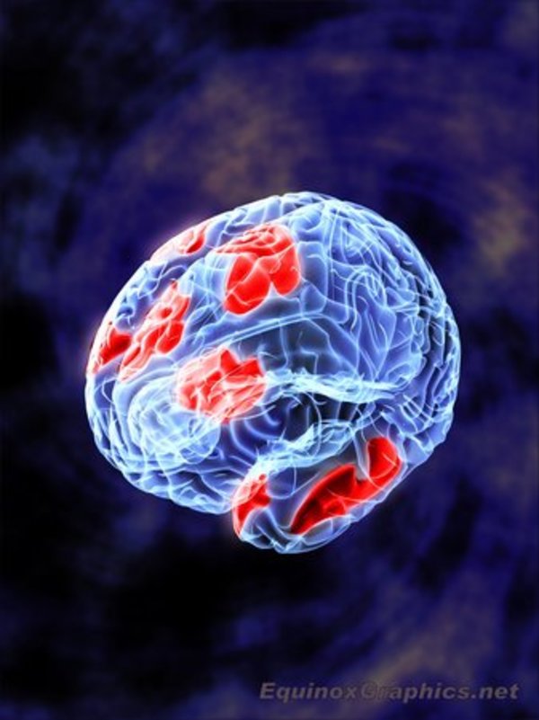 Brain Stimulation by Dr Jon Heras