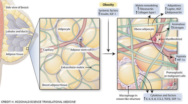 Obesity and breast cancer risk by Heather McDonald