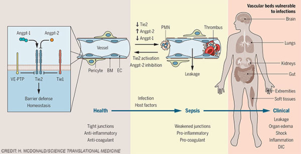 Targeting a signaling molecule in sepsis by Heather McDonald