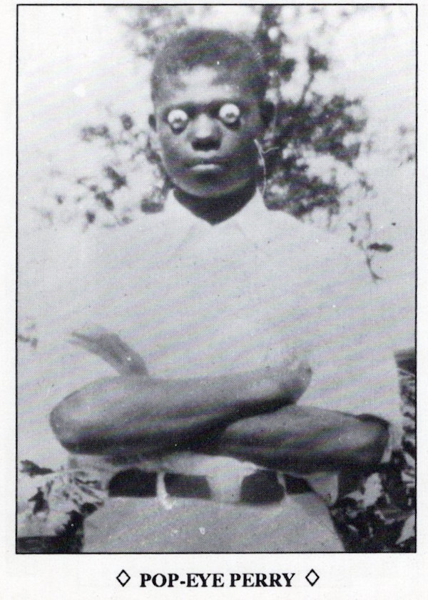 William "Pop-Eye" Perry, from Freakards II: Portraits of Peculiar People by Unknown