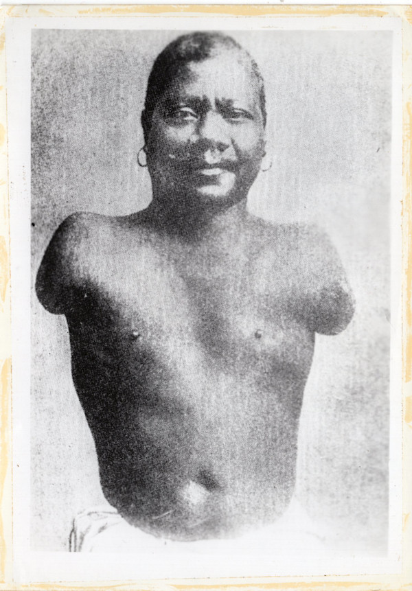 Prince Randian (1871 – 1934) by Unknown