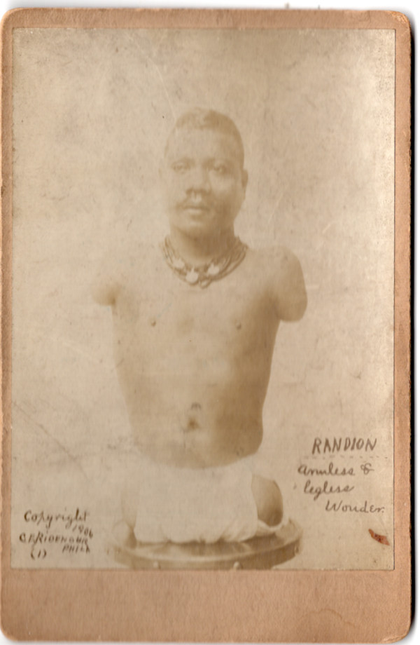 Prince Randian (1871 – 1934) by Unknown