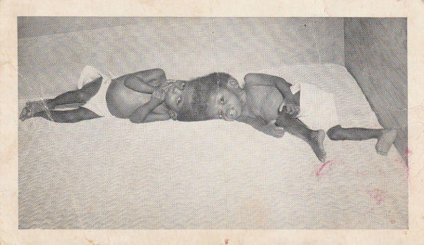 Yvonne & Yvette McCarther (1949 - 1992) by Unknown