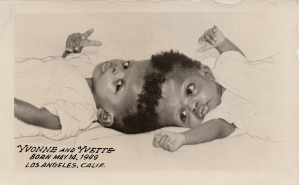 Yvonne & Yvette McCarther (1949 - 1992) by Unknown