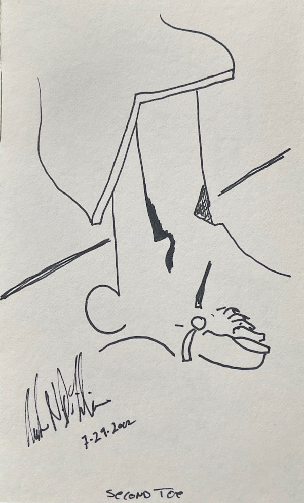 Second Toe  ** by Angelo DeFilippo