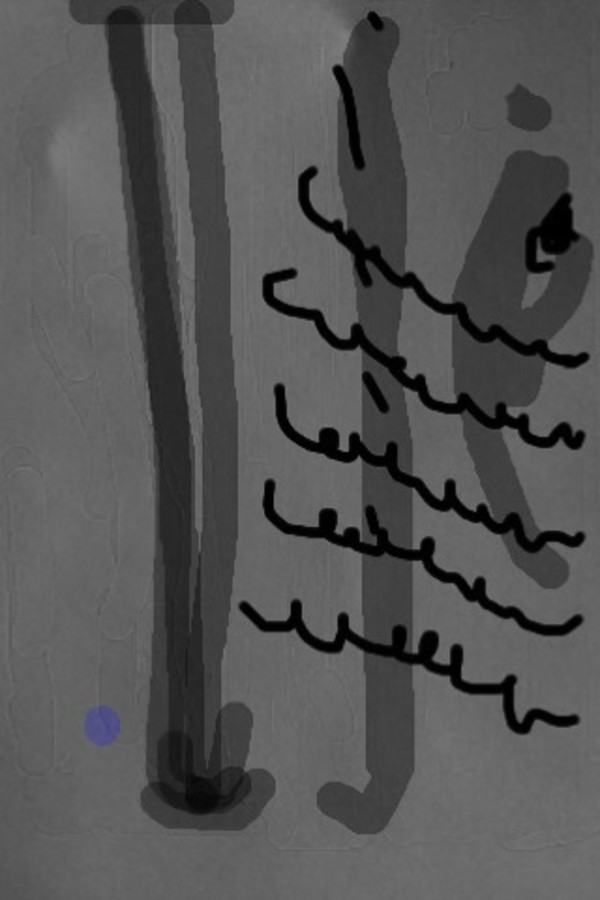 Untitled 613 by Angelo DeFilippo, Image 1.