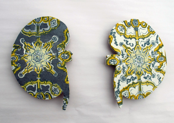 Night Kidney and Day Kidney by April Vollmer