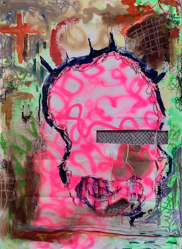 Brain Bleed