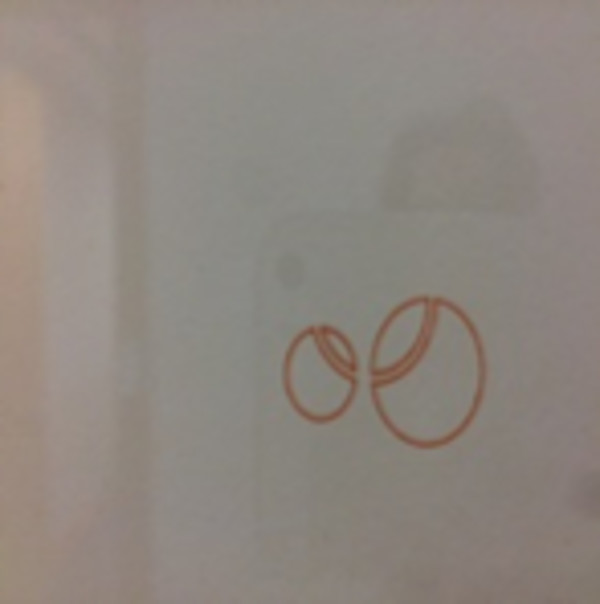 Rings ii by Tess Jaray, Image 1.