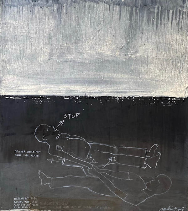 SHOULDER DISLOCATION by saskia pintelon