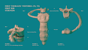 T1, T2, Rib 1, Sternum