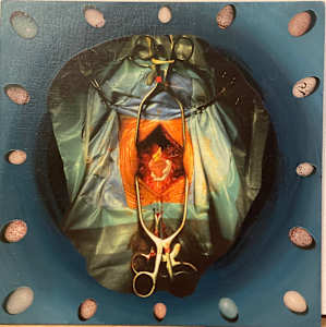 Heart Surgery