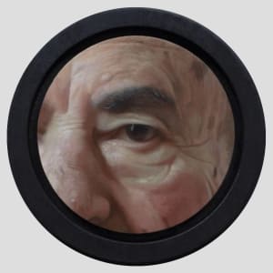 Adam Shtibel's Eye