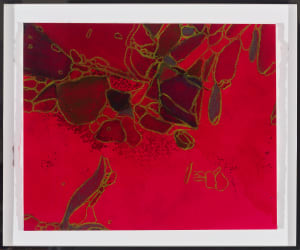 From Erythrocyte #3