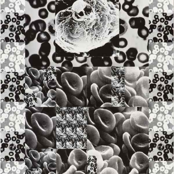AIDS Pyramid by Carl Tandatnick, Image 1.