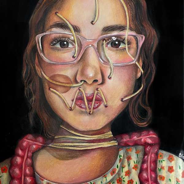 Digested by Beatriz Fraga - Neurosarcoidosis, Image 1.