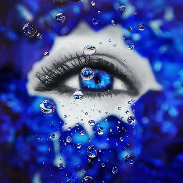 Dreamy Delirium by Elizabeth Hoverman - Ectrodactyly-Ectodermal Dysplasia-Clefting (EEC) Syndrome, Image 1.
