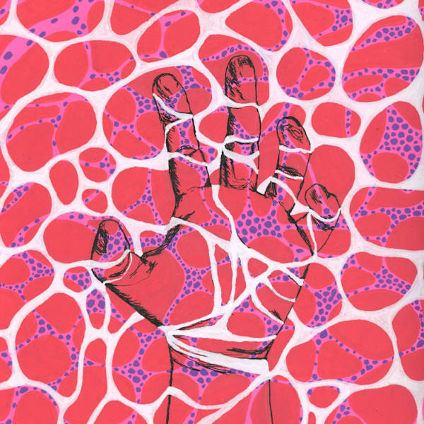 Staying Afloat With A Rare Disease by Waiyee Hui - Antisynthetase Syndrome, Image 1.