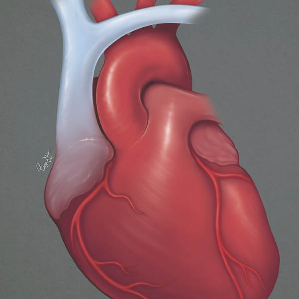 Anatomical Heart by Bryona Hamilton, Image 1.