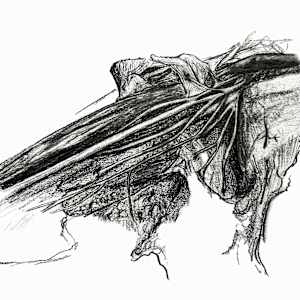 Brachial Plexus by Becca Lewis