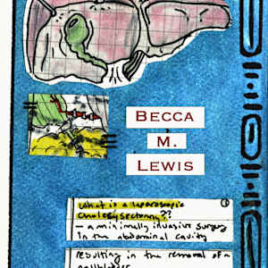 What the Hell is a Laparoscopic Cholecystectomy?? by Becca Lewis 