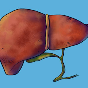 What the Hell is a Laparoscopic Cholecystectomy?? by The Art of Dissection, Image 1.