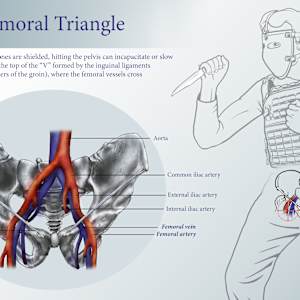 The Femoral Triangle by Becca Lewis