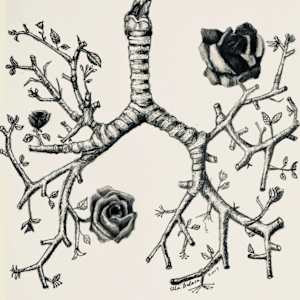 Lungs of Life by Ella Balasa - Cystic Fibrosis, Image 1.