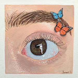 Behind The Eye by Sarah Dillon - Thyroid Eye Disease, Image 1.