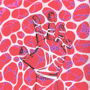 Staying Afloat With A Rare Disease by Waiyee Hui - Antisynthetase Syndrome, Image 1.
