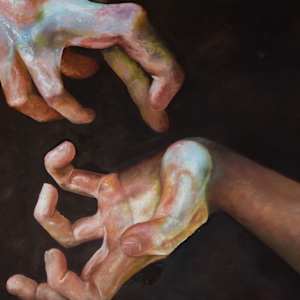 Hands of Resilience by Emma Schaberg - Marfan Syndrome, Image 1.