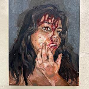 I Told You to Stop Picking! by Abigail Malek, Image 1.