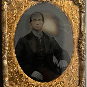 Young Man Sitting with Moon Shaped Damage