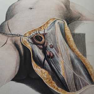 18_ Pain, Nodes and Nails by Andreina Davila 