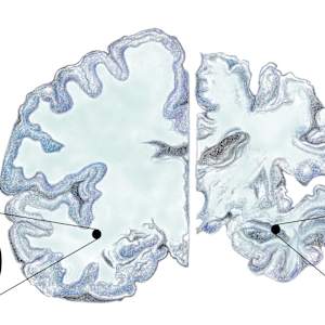 Alzheimer's mitochondrial dysfunction by Shana Katzman, Image 1.
