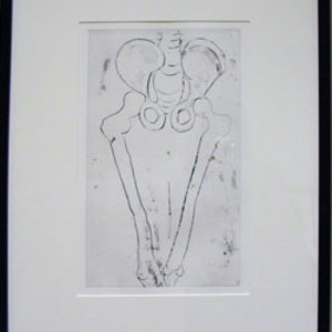 Untitled (from the Anatomy portfolio) by Louise Bourgeois