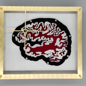 my stimulated brain 1/5 by Angela Ridgway 