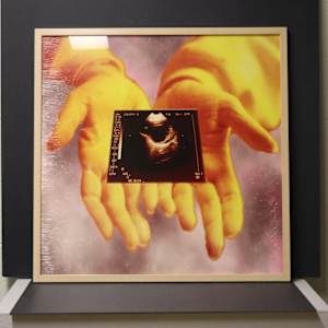 Infertility: Sonogram by Jeri Robinson