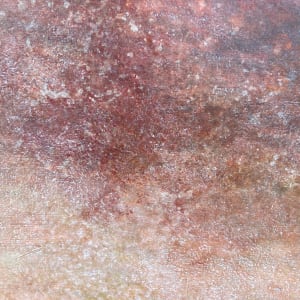 Rest  Image: Rest detail