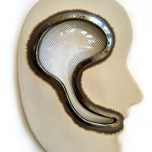 Anomic Aphasia by Kelly Witmer, Image 2.